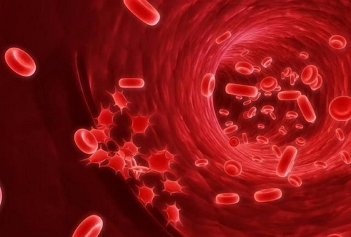 Ինչու՞ է առաջանում արյան քաղցկեղ