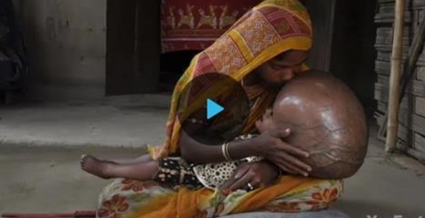 Ժամանակակից աշխարհի ամենաբացառիկ հիվանդությունները (տեսանյութ)